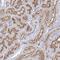 Coiled-Coil Domain Containing 73 antibody, NBP2-32641, Novus Biologicals, Immunohistochemistry paraffin image 