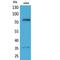 Tumor Protein P73 antibody, LS-C387106, Lifespan Biosciences, Western Blot image 