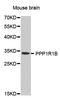 Protein Phosphatase 1 Regulatory Inhibitor Subunit 1B antibody, STJ25084, St John