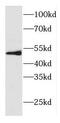 Carboxypeptidase N Subunit 1 antibody, FNab01925, FineTest, Western Blot image 