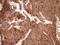 Matrix Metallopeptidase 3 antibody, LS-C798356, Lifespan Biosciences, Immunohistochemistry paraffin image 