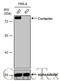 Cortactin antibody, GTX113681, GeneTex, Western Blot image 