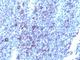 Glypican 3 antibody, V2539IHC-7ML, NSJ Bioreagents, Immunohistochemistry paraffin image 