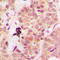 Phosphatase And Tensin Homolog antibody, LS-C354073, Lifespan Biosciences, Immunohistochemistry frozen image 