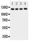 Platelet Derived Growth Factor Receptor Alpha antibody, PA1678, Boster Biological Technology, Western Blot image 