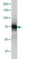 Interleukin 1 Receptor Associated Kinase 1 antibody, H00003654-M01, Novus Biologicals, Western Blot image 