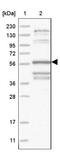 T Cell Activation RhoGTPase Activating Protein antibody, NBP1-88826, Novus Biologicals, Western Blot image 