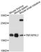 TNF Alpha Induced Protein 8 Like 2 antibody, A13698, ABclonal Technology, Western Blot image 