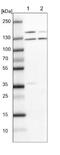 DEAH-Box Helicase 38 antibody, NBP1-85269, Novus Biologicals, Western Blot image 