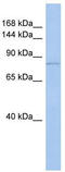 Transient Receptor Potential Cation Channel Subfamily V Member 4 antibody, TA338698, Origene, Western Blot image 