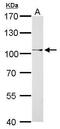 C-Terminal Binding Protein 2 antibody, GTX102582, GeneTex, Western Blot image 