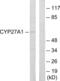 Sterol 26-hydroxylase, mitochondrial antibody, abx013980, Abbexa, Western Blot image 