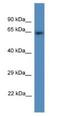 CDK5 Regulatory Subunit Associated Protein 1 antibody, NBP1-79651, Novus Biologicals, Western Blot image 