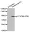 Signal Transducer And Activator Of Transcription 5A antibody, abx000191, Abbexa, Western Blot image 