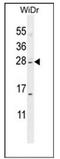 IQ Motif Containing F1 antibody, AP52228PU-N, Origene, Western Blot image 