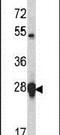 Heat Shock Protein Family B (Small) Member 1 antibody, PA5-14023, Invitrogen Antibodies, Western Blot image 