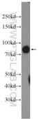 Solute Carrier Organic Anion Transporter Family Member 4C1 antibody, 24584-1-AP, Proteintech Group, Western Blot image 