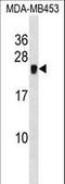 Cysteine Rich Protein 2 antibody, LS-C167042, Lifespan Biosciences, Western Blot image 