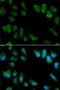 Interleukin 1 Receptor Antagonist antibody, orb48417, Biorbyt, Immunofluorescence image 