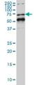 Nuclear Receptor Subfamily 1 Group D Member 1 antibody, H00009572-M02, Novus Biologicals, Western Blot image 