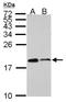 Actin Related Protein 2/3 Complex Subunit 5 antibody, NBP2-14878, Novus Biologicals, Western Blot image 