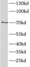 TGF-Beta Activated Kinase 1 (MAP3K7) Binding Protein 2 antibody, FNab09979, FineTest, Western Blot image 