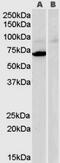 Frizzled-8 antibody, 45-636, ProSci, Western Blot image 