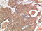 ATM Serine/Threonine Kinase antibody, GTX34048, GeneTex, Immunohistochemistry paraffin image 