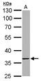 Transmembrane Protein 59 antibody, LS-C185624, Lifespan Biosciences, Western Blot image 