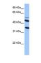 Interleukin 13 Receptor Subunit Alpha 2 antibody, NBP1-69687, Novus Biologicals, Western Blot image 
