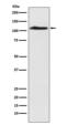 Chromodomain Helicase DNA Binding Protein 1 Like antibody, M05749-1, Boster Biological Technology, Western Blot image 