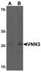 Vanin 3 antibody, TA326633, Origene, Western Blot image 