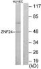 Zinc Finger Protein 24 antibody, TA314688, Origene, Western Blot image 