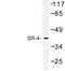 5-Hydroxytryptamine Receptor 4 antibody, LS-C177076, Lifespan Biosciences, Western Blot image 