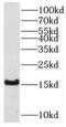 Acyl-CoA Thioesterase 13 antibody, FNab08662, FineTest, Western Blot image 