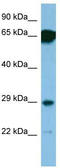 Sm-D antibody, TA345830, Origene, Western Blot image 