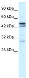 Cholinergic Receptor Nicotinic Alpha 3 Subunit antibody, TA330421, Origene, Western Blot image 