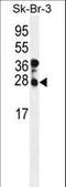 Charged Multivesicular Body Protein 4B antibody, LS-C168740, Lifespan Biosciences, Western Blot image 