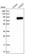 WSC Domain Containing 1 antibody, PA5-53399, Invitrogen Antibodies, Western Blot image 