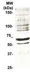 Transforming Growth Factor Beta Receptor 1 antibody, TA354905, Origene, Western Blot image 