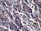 RAN, Member RAS Oncogene Family antibody, A00204-1, Boster Biological Technology, Immunohistochemistry paraffin image 