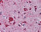 LDL Receptor Related Protein 8 antibody, ARP44723_P050, Aviva Systems Biology, Immunohistochemistry paraffin image 