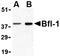 BCL2 Related Protein A1 antibody, orb74742, Biorbyt, Western Blot image 