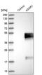 Asialoglycoprotein Receptor 1 antibody, PA5-52885, Invitrogen Antibodies, Western Blot image 