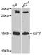 Cystatin F antibody, A08883, Boster Biological Technology, Western Blot image 