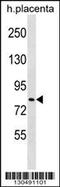 HECT Domain E3 Ubiquitin Protein Ligase 2 antibody, 60-076, ProSci, Western Blot image 