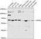 Corticotropin Releasing Hormone Receptor 1 antibody, 23-564, ProSci, Western Blot image 