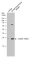 Bone Marrow Stromal Cell Antigen 2 antibody, GTX130221, GeneTex, Western Blot image 