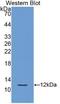 Plasminogen Activator, Urokinase Receptor antibody, abx131797, Abbexa, Western Blot image 