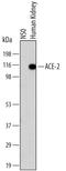 Angiotensin I Converting Enzyme 2 antibody, MAB933, R&D Systems, Western Blot image 